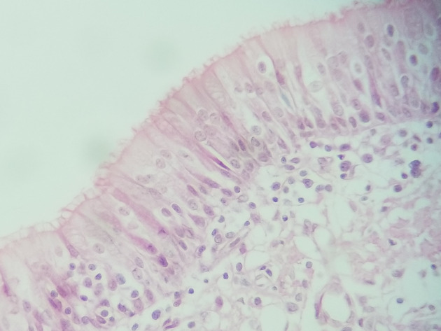 Pseudostratified Epithelium Slides - Pseudostratified Epithelium 14 400X